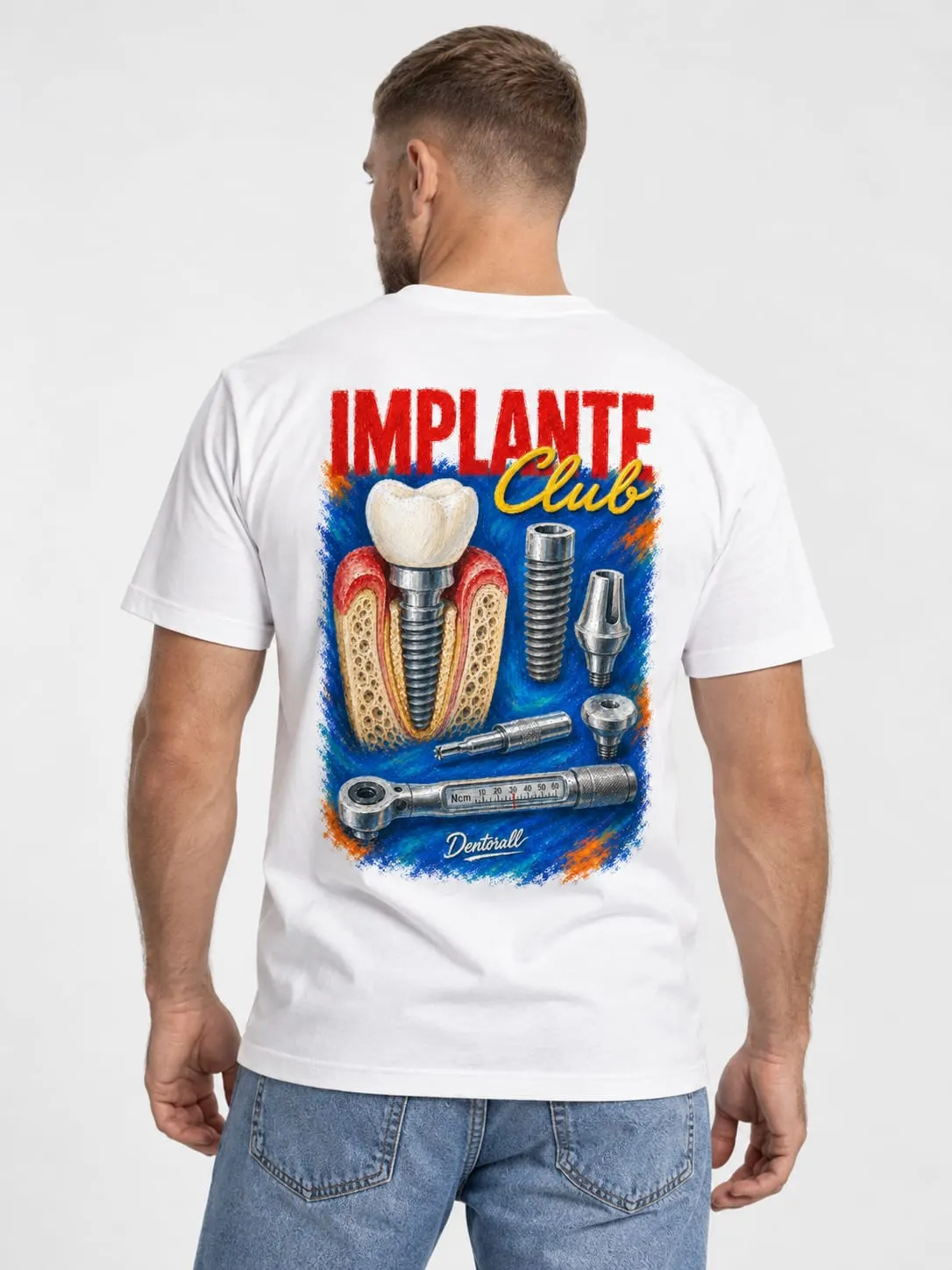 Implante Club